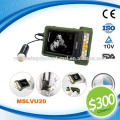 "$300 Coupon" Cheapest portable ultrasound machine with CE, MSLVU20M